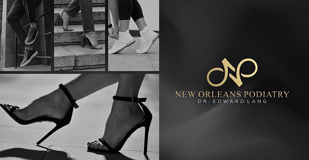 People running in athletic shoes outdoors.